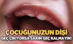 Çocuğunuzun dişi geç çıkıyorsa sakın geç kalmayın!