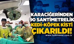 Karaciğerinden 90 santimetrelik kedi-köpek kisti çıkarıldı