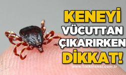 Keneyi vücuttan çıkartırken dikkat