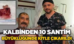 Kalbinden 10 santim büyüklüğünde kitle çıkarıldı