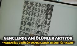Gençlerde ani ölümler artıyor: "Nedeni ise virüsün damarlarda bıraktığı hasar"