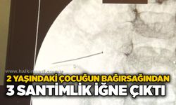 2 yaşındaki çocuğun bağırsağından 3 santimlik iğne çıktı