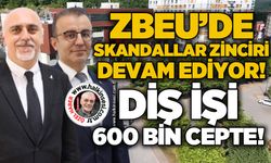 ZBEU'de skandallar zinciri devam ediyor: Diş işi, 600 bin TL cepte!