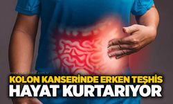 Kolon kanserinde erken teşhis hayat kurtarıyor