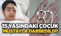 15 yaşındaki çocuk muştayla darbedildi!
