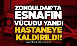 Zonguldak'ta esnafın vücudu yandı, hastaneye kaldırıldı!