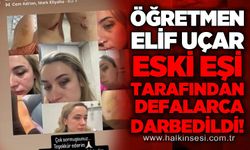 Fen Bilgisi Öğretmeni Elif Uçar, eski eşi tarafından defalarca darbedildi!