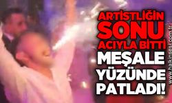 Düğünde ağzında tuttuğu meşale ağzında patladı!