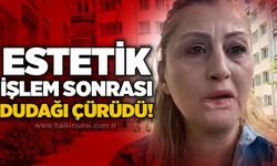 Estetik işlem sonrası dudağı çürüdü!