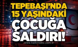 Tepebaşı'nda 15 yaşındaki çocuğa saldırı: Zonguldak Belediyesi'ne çağrı!