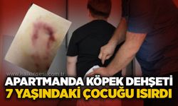Apartmanda köpek dehşeti: 7 yaşındaki çocuğu ısırdı