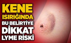 Kene ısırığında bu belirtiye dikkat: Lyme riski