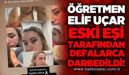 Fen Bilgisi Öğretmeni Elif Uçar, eski eşi tarafından defalarca darbedildi!