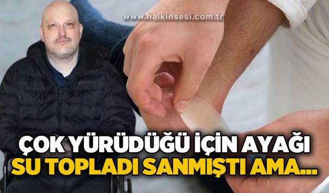 Çok yürüdüğü için ayağı su topladı sanmıştı ama...