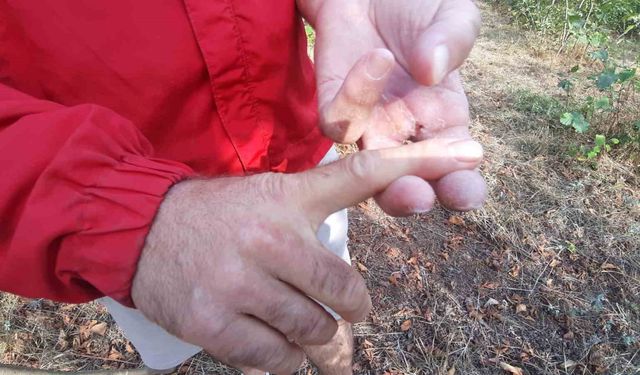 Ayının saldırısına uğrayan çiftçi dehşet anlarını anlattı: "Parmağımı kopardı"