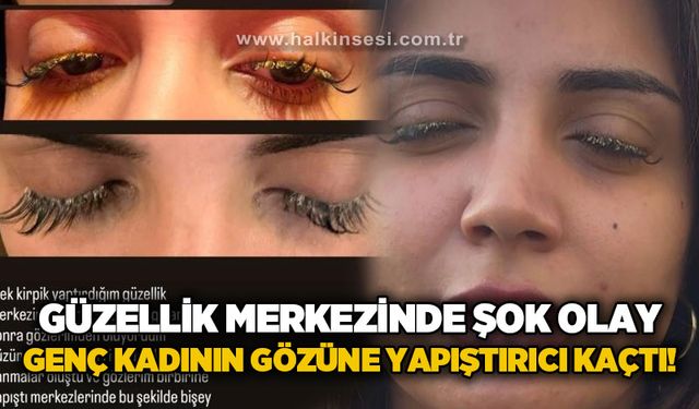 Güzellik merkezinde genç kadının gözüne yapıştırıcı kaçtı: "Kör olabilirdim"