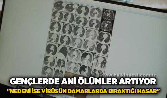Gençlerde ani ölümler artıyor: "Nedeni ise virüsün damarlarda bıraktığı hasar"