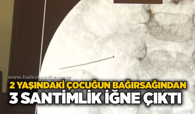 2 yaşındaki çocuğun bağırsağından 3 santimlik iğne çıktı