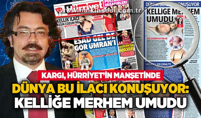 Dünya bu ilacı konuşuyor: Kelliğe merhem umudu: Kargı, Hürriyet’in manşetinde