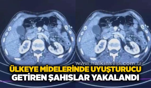 Ülkeye midelerinde u*uşturucu getiren şahıslar yakalandı