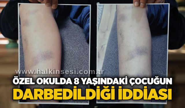 Özel okulda 8 yaşındaki çocuğun darbedildiği iddiası