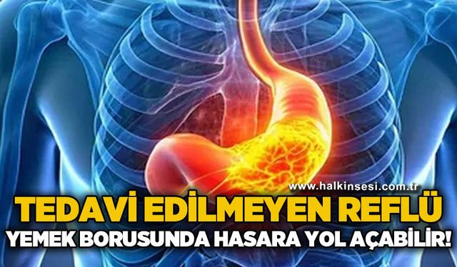 Uzman uyardı: Tedavi edilmeyen reflü yemek borusunda hasara yol açabilir