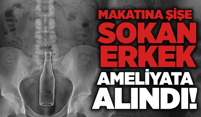 Makatına şişe sokan erkek ameliyata alındı!