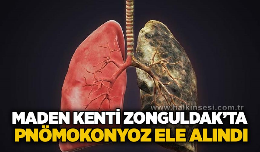 Maden kenti Zonguldak’ta pnömokonyoz ele alındı