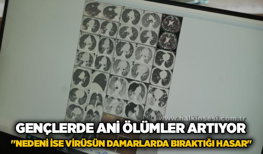 Gençlerde ani ölümler artıyor: "Nedeni ise virüsün damarlarda bıraktığı hasar"