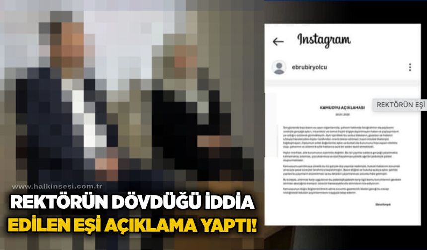 Rektörün dövdüğü iddia edilen eşi açıklama yaptı!