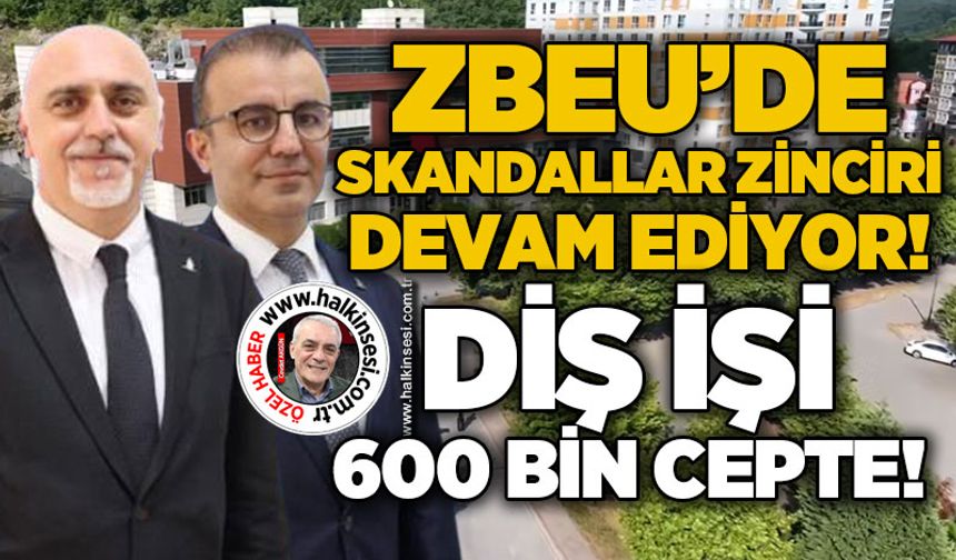 ZBEU'de skandallar zinciri devam ediyor: Diş işi, 600 bin TL cepte!