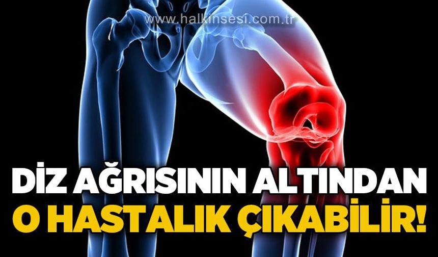 Diz ağrılarının altından o hastalık çıkabilir!
