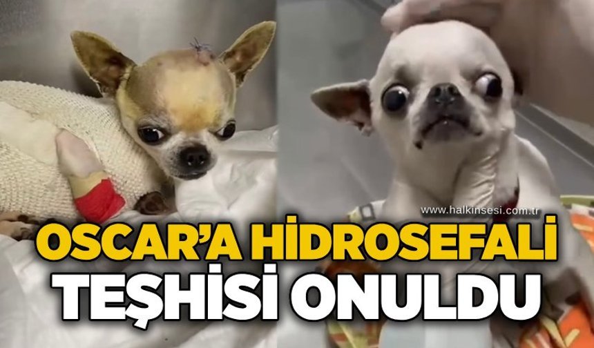 Oscar’a hidrosefali teşhisi konuldu