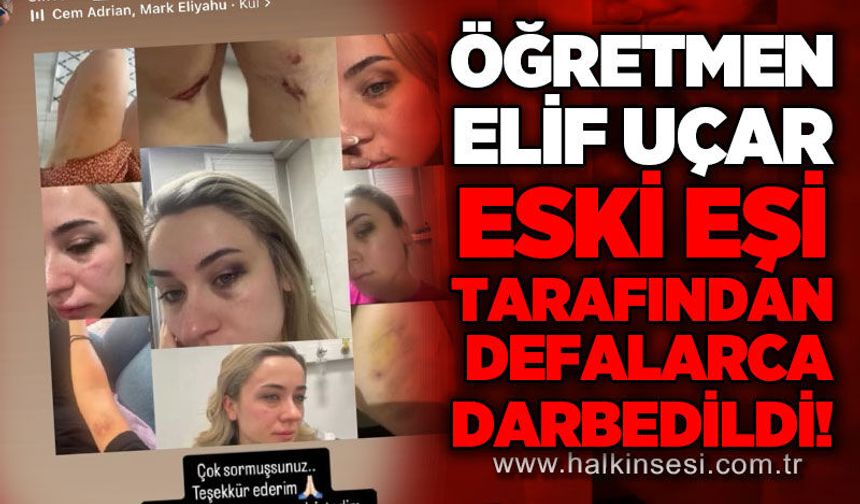 Fen Bilgisi Öğretmeni Elif Uçar, eski eşi tarafından defalarca darbedildi!
