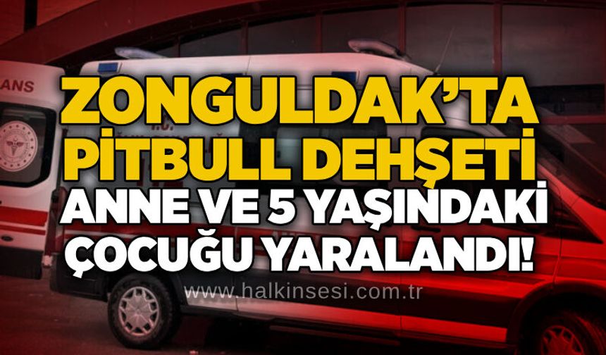 Zonguldak’ta pitbull dehşeti: Anne ve 5 yaşındaki çocuğu yaralandı!