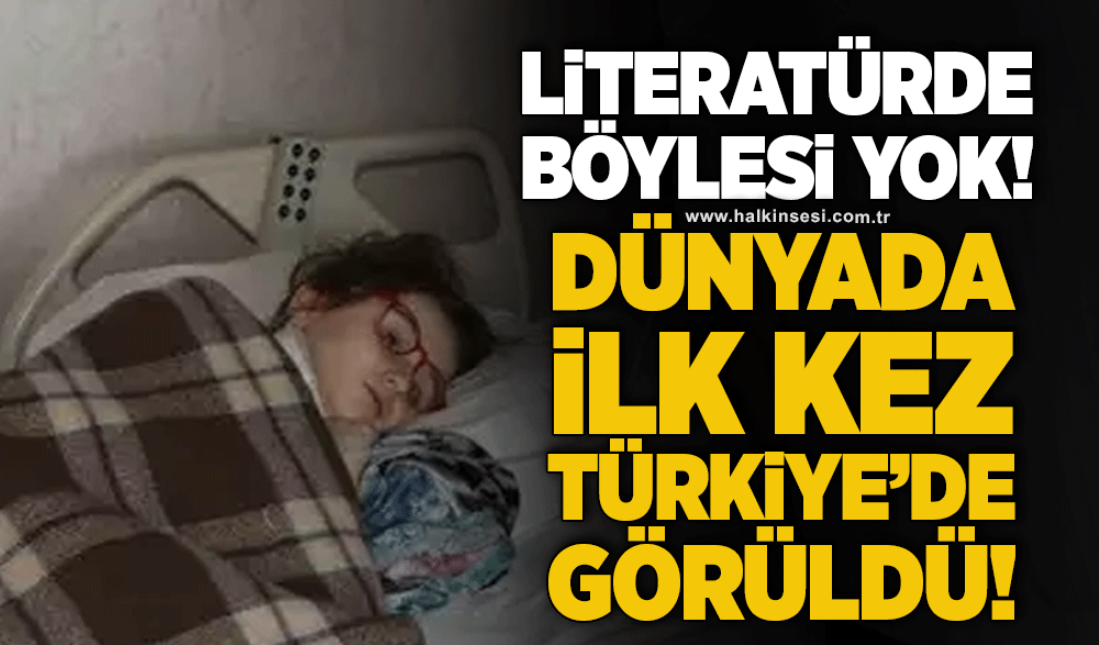 Literatürde böylesi yok! Dünyada ilk kez Türkiye'de görüldü!