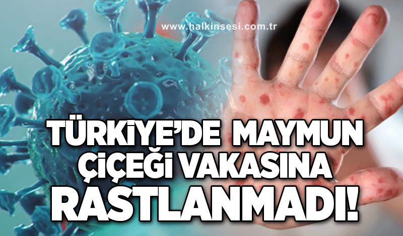 Türkiye'de maymun çiçeği vakasına rastlanmadı