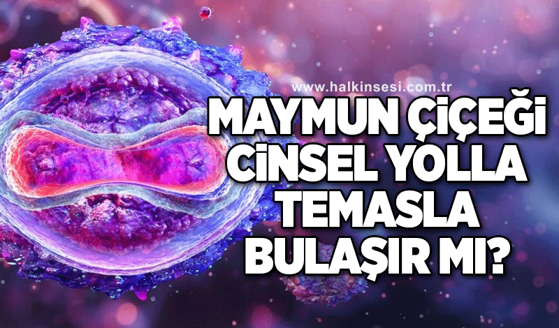 Maymun çiçeği cinsel yolla, temasla bulaşır mı?