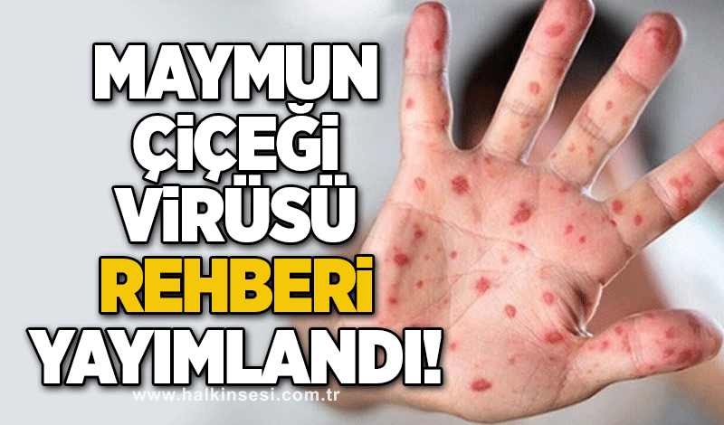 Maymun Çiçeği Virüsü Rehberi yayımlandı