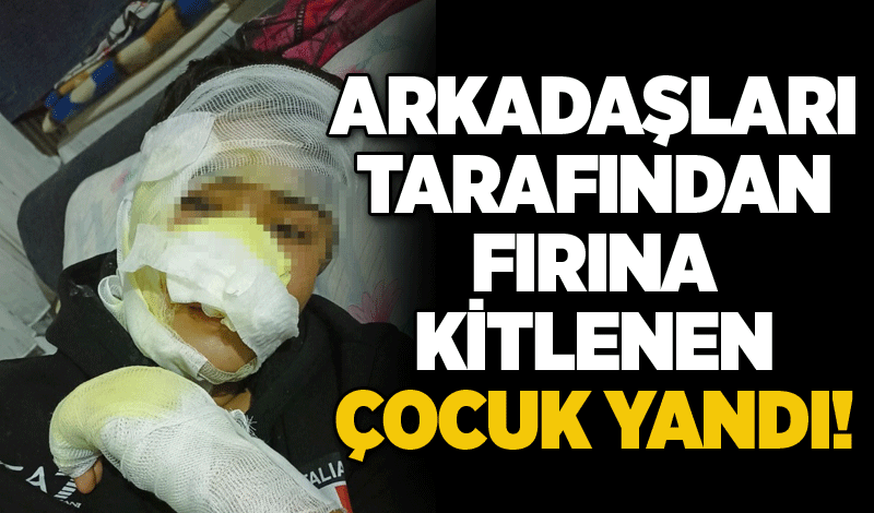 Arkadaşları tarafından fırına kitlenen çocuk yandı!