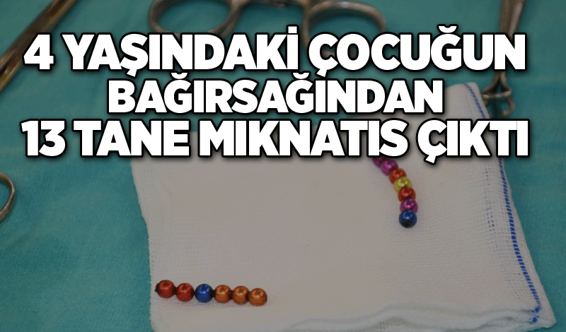 4 yaşındaki çocuğun bağırsağından 13 tane mıknatıs çıktı