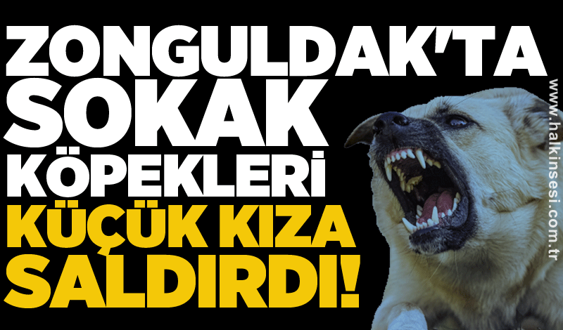 Zonguldak'ta sokak köpekleri küçük kıza saldırdı!