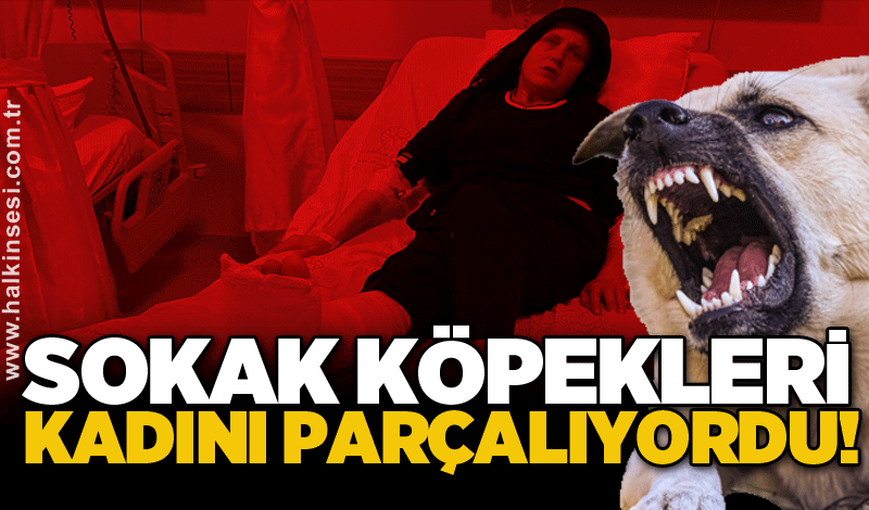 Sokak köpekleri kadını parçalıyordu!