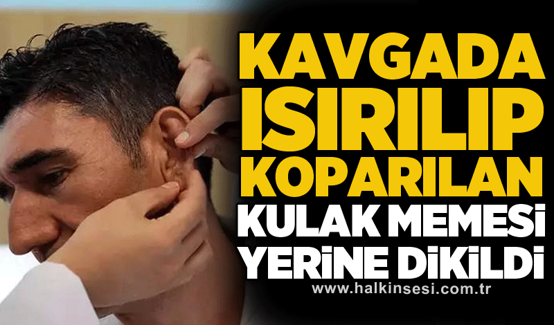 Kavgada ısırılıp koparılan kulak memesi yerine dikildi