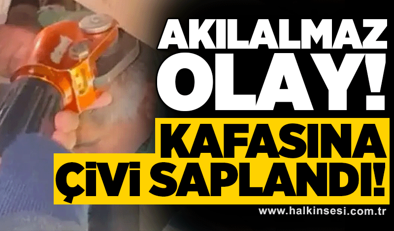 Akılalmaz olay! Kafasına çivi saplandı!