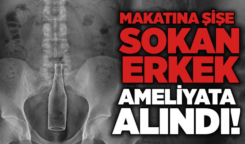 Makatına şişe sokan erkek ameliyata alındı!