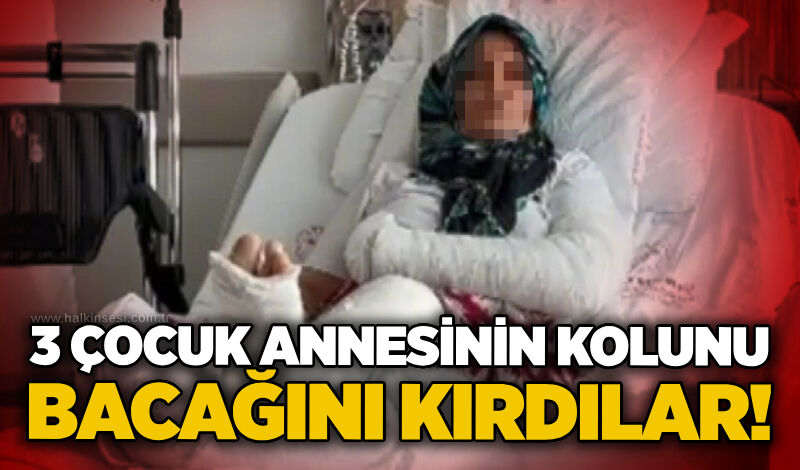 3 çocuk annesinin kolunu bacağını kırdılar!
